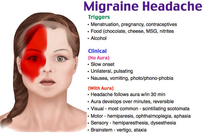 Migraine Headache Stages Causes And Medication Let S Talk About