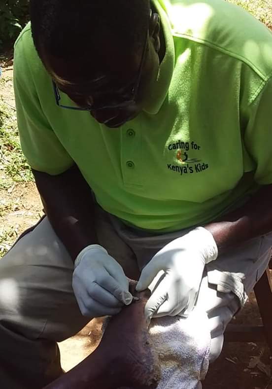 Jigger Infestation; A Disease Related To Poverty The Path