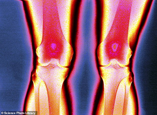 Vitamin D’s main role is in helping your body absorb calcium from food. If you don’t get enough, the body draws calcium out of your bones which, over time, makes them more fragile