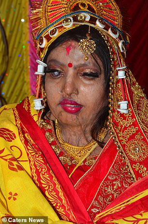 India: A woman who survived 'acid attack', marries a long-time friend (Photos)