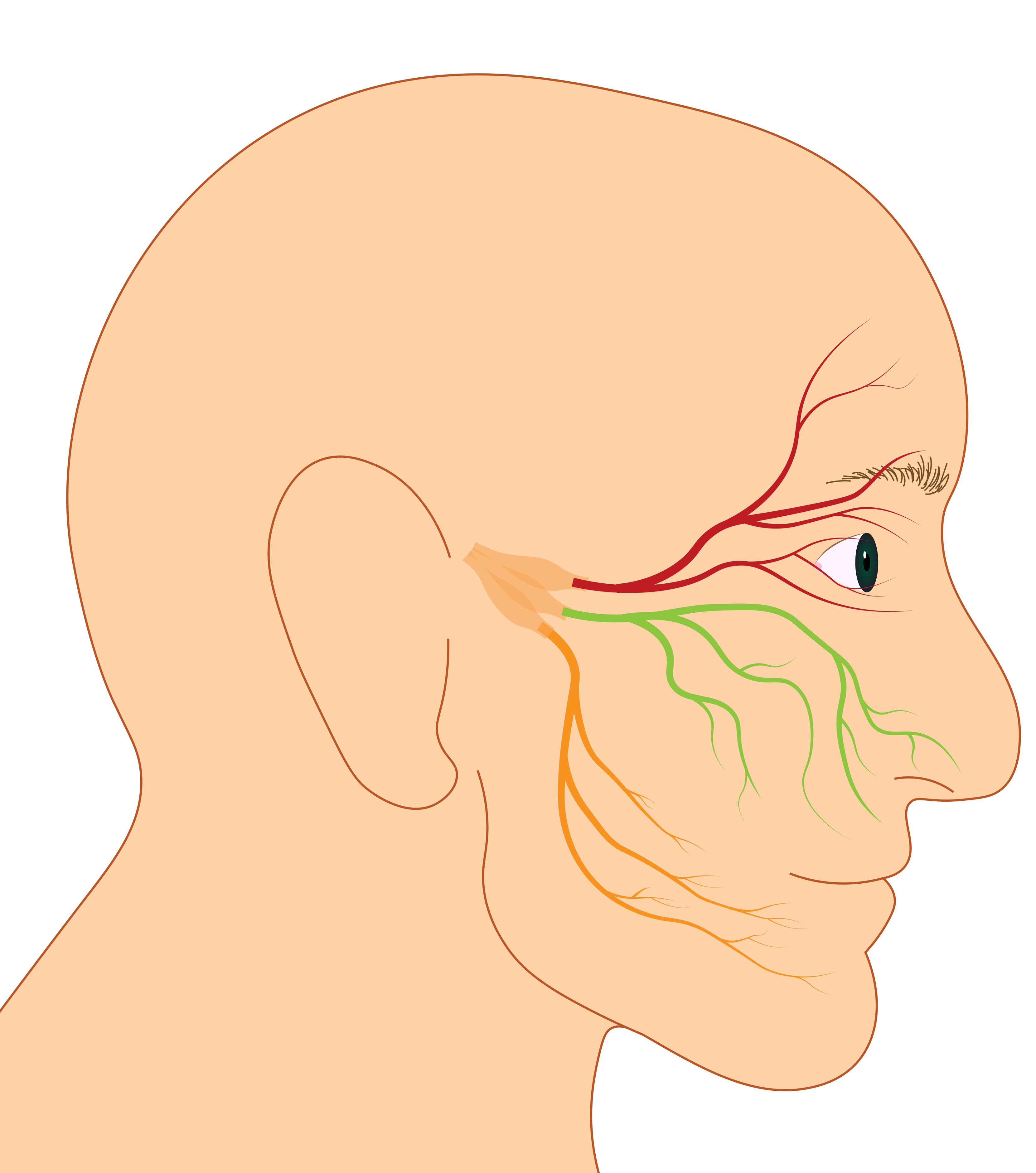 Medical illustration of facial nerve pathways showing complex branching across the side of a human face, highlighting nerves near the eye and mouth