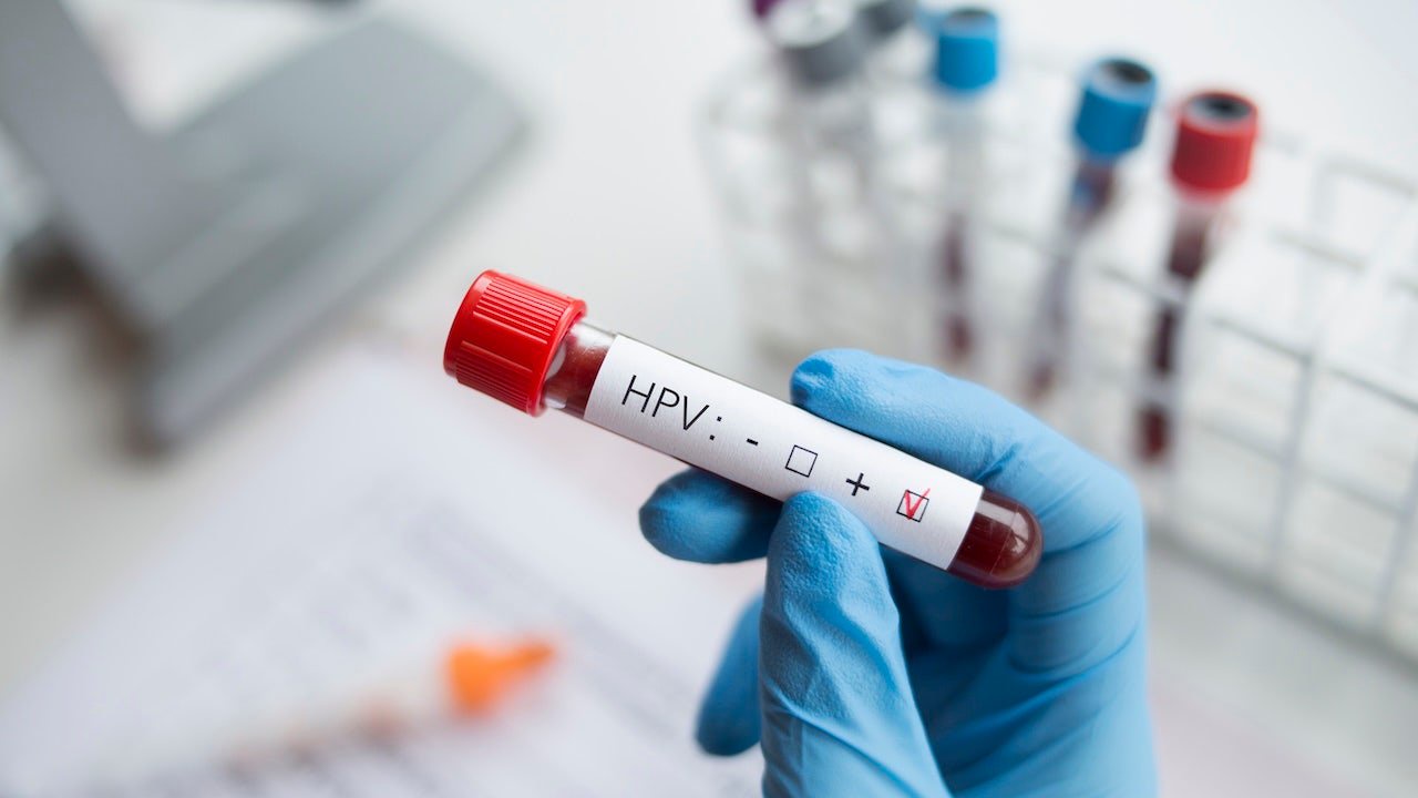 HPV blood test