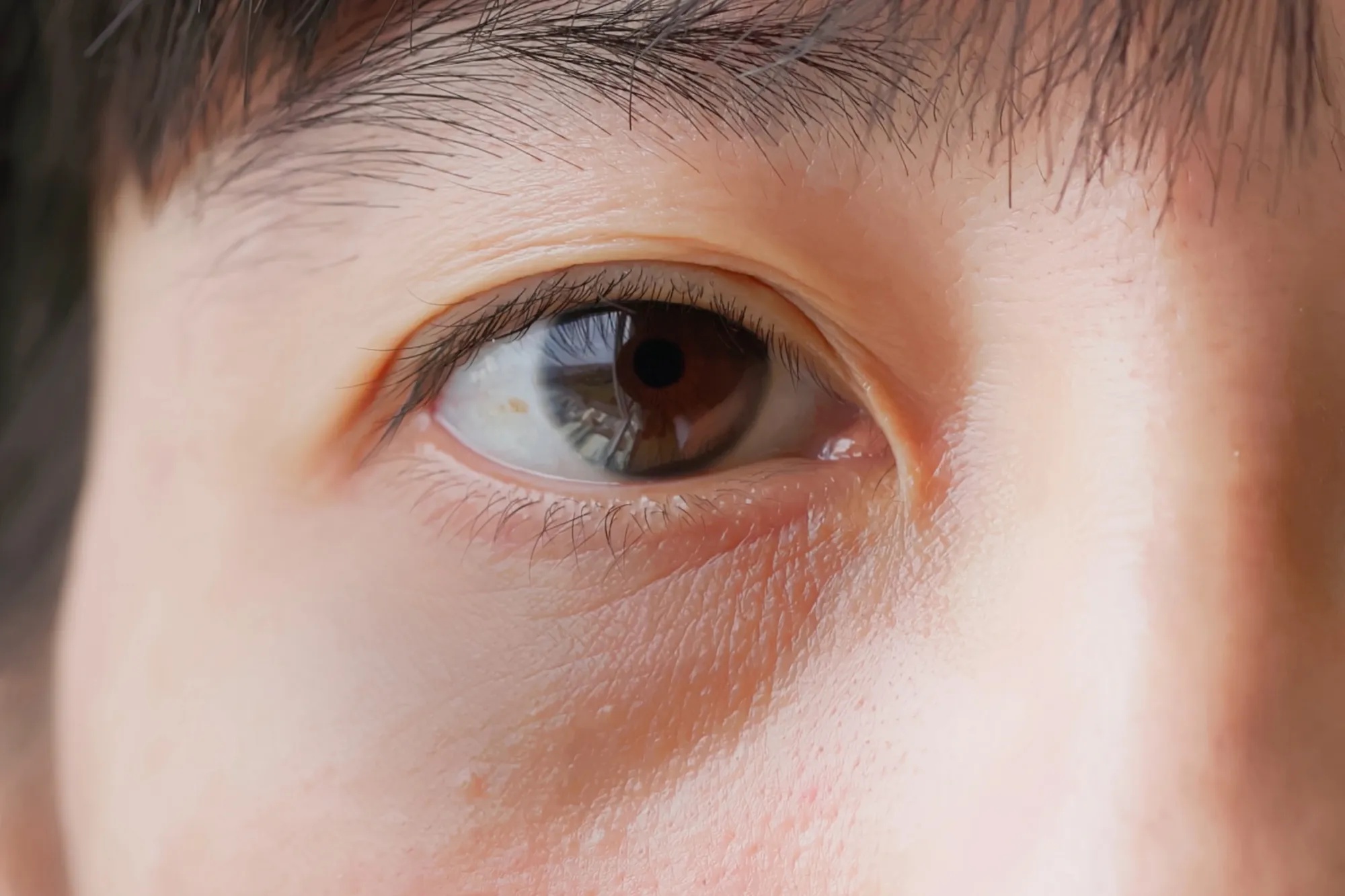 Stock, asian woman with dark circles around eyes close-up view