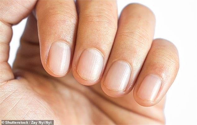 Weight-loss jabs increase the risk of painful and unsightly nail problems, with nail detachment more than four times as common in fat jab users