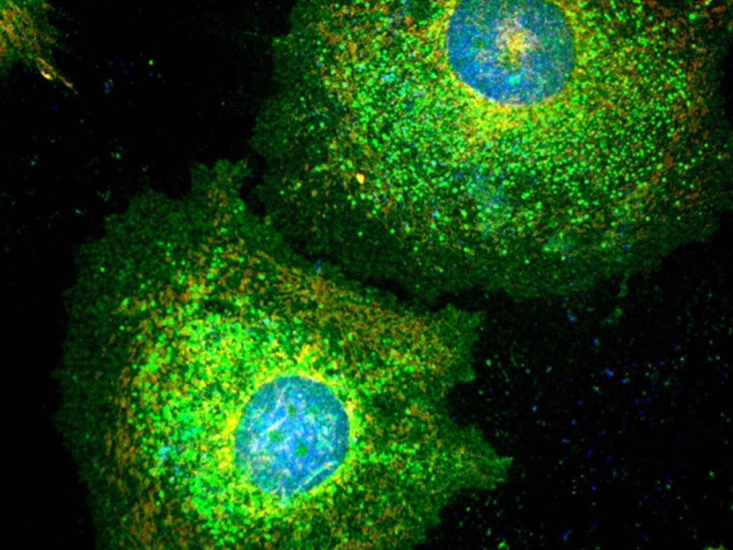 Scientists discover how tumors play dead to dodge chemotherapy