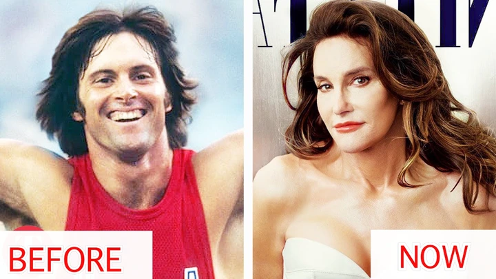 Before after and celebrity transgender 10 Handsome