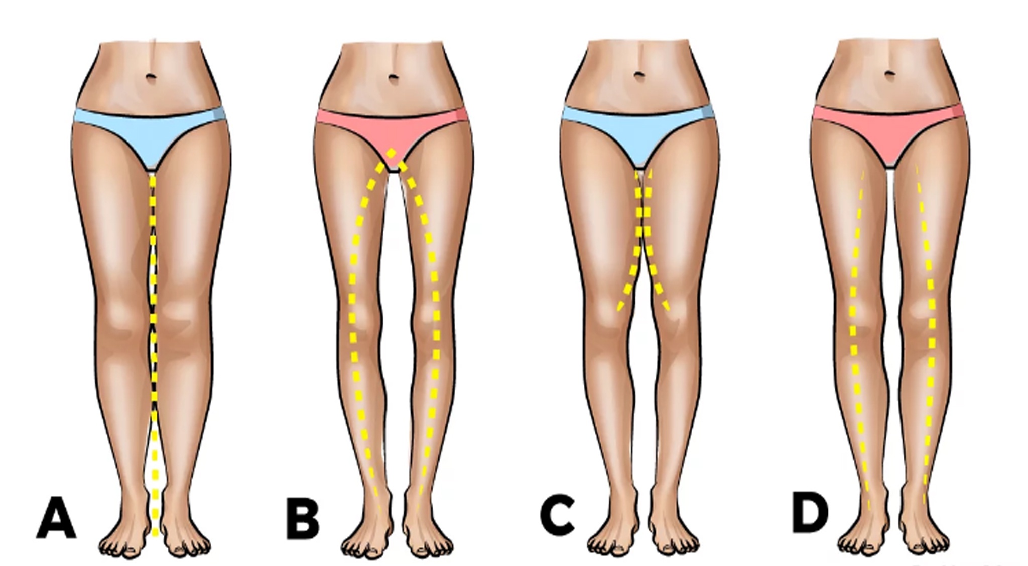 0287d68858a1187d2f7b622eeabbf859-1?source=nlp&quality=uhq&format=webp&resize=720