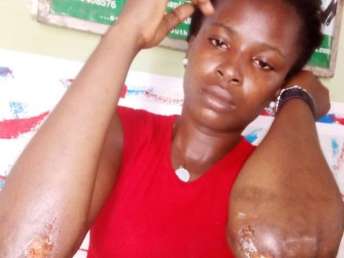 How I jumped out of moving car to escape kidnap