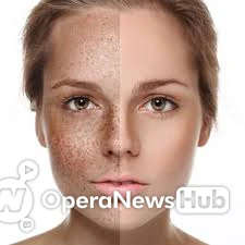 09ca89cc62d020684e0f371374085001?quality=uhq&format=webp&resize=720&watermark=true