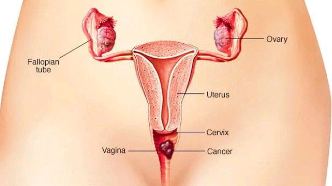 Every Woman Should Avoid Womb Damage By Staying Away From This Four Things