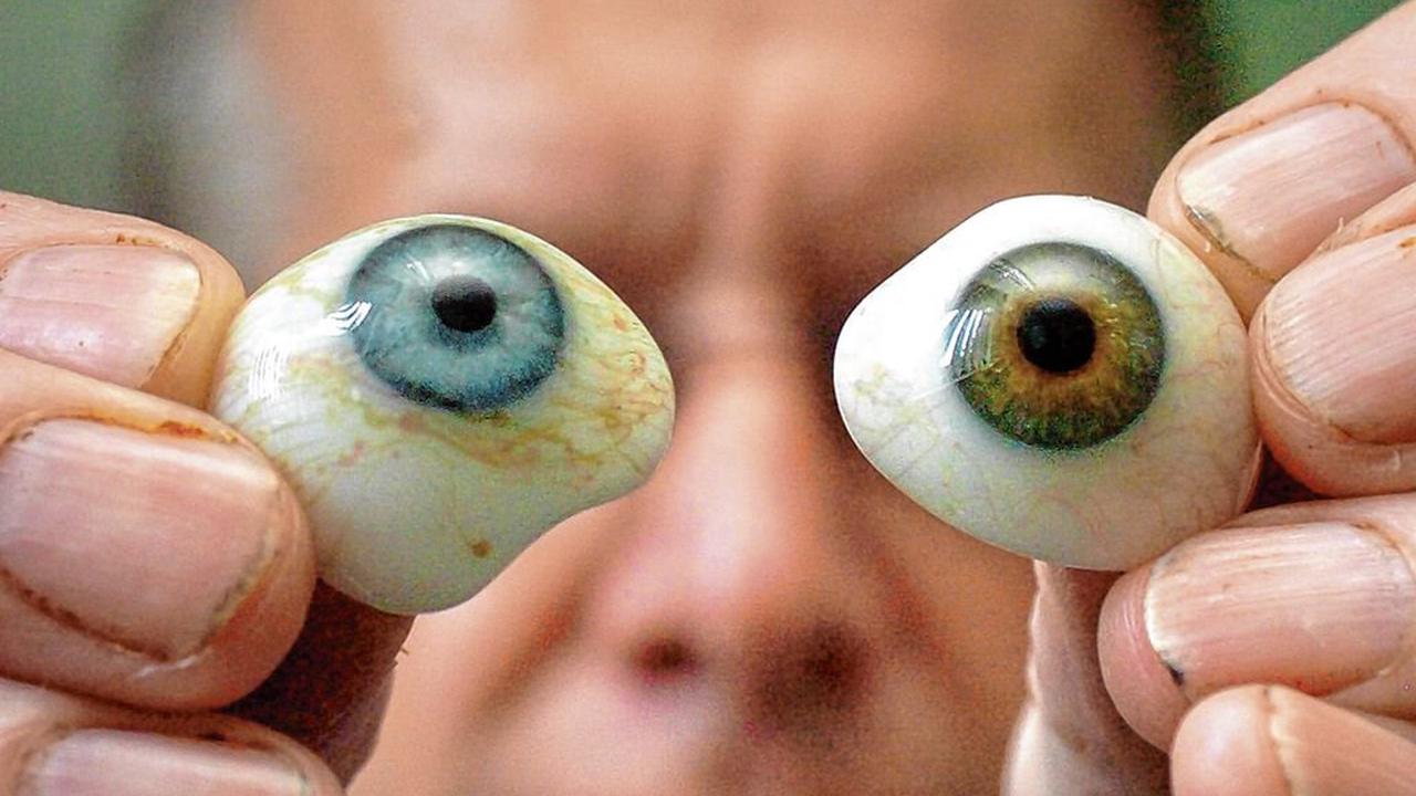 Weltweite Premiere: Mann bekommt künstliches Auge aus dem 3D-Drucker