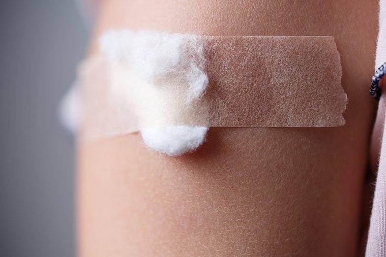 little girl with plaster on the shoulder from the injection, vaccinated in the shoulder, child vaccination, treatment of childrenpatch