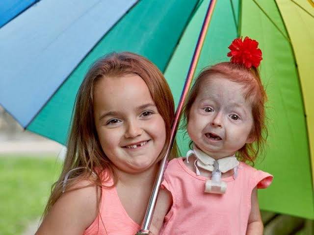 kids who are walking medical miracles