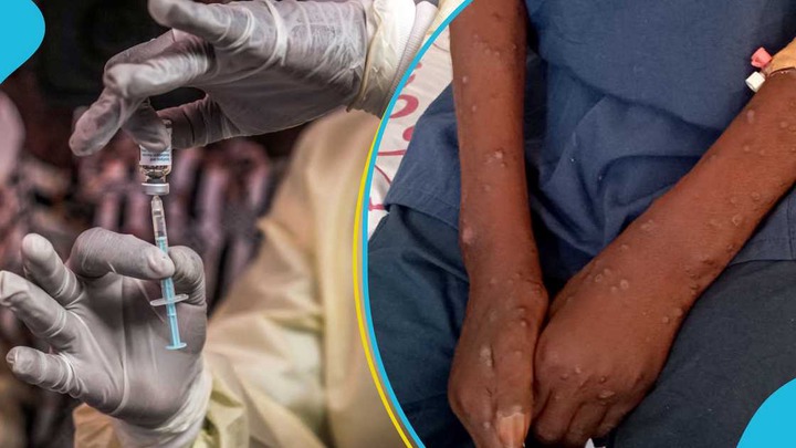 Ghana Launches National Committee to Tackle Mpox, Cholera, and Meningitis Outbreaks