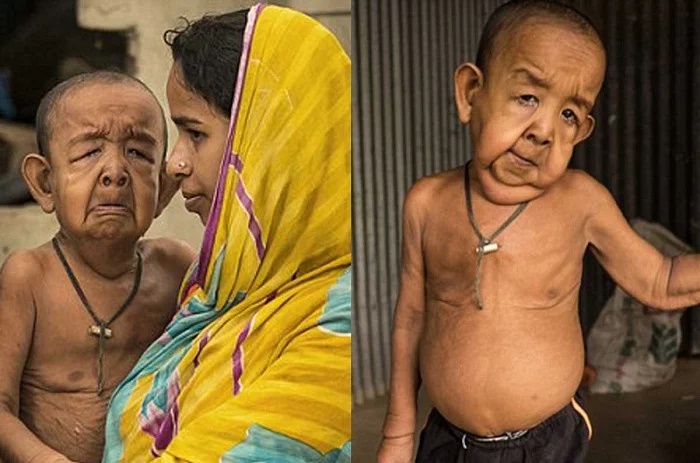 Benjamin Button Opera News Cote D Ivoire