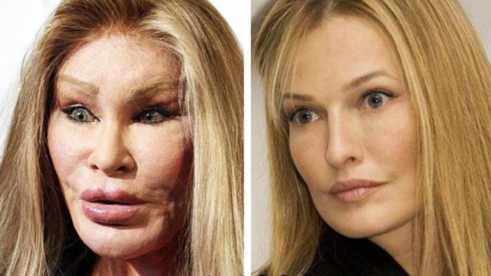 Jocelyn Wildenstein Opera News Cote D Ivoire
