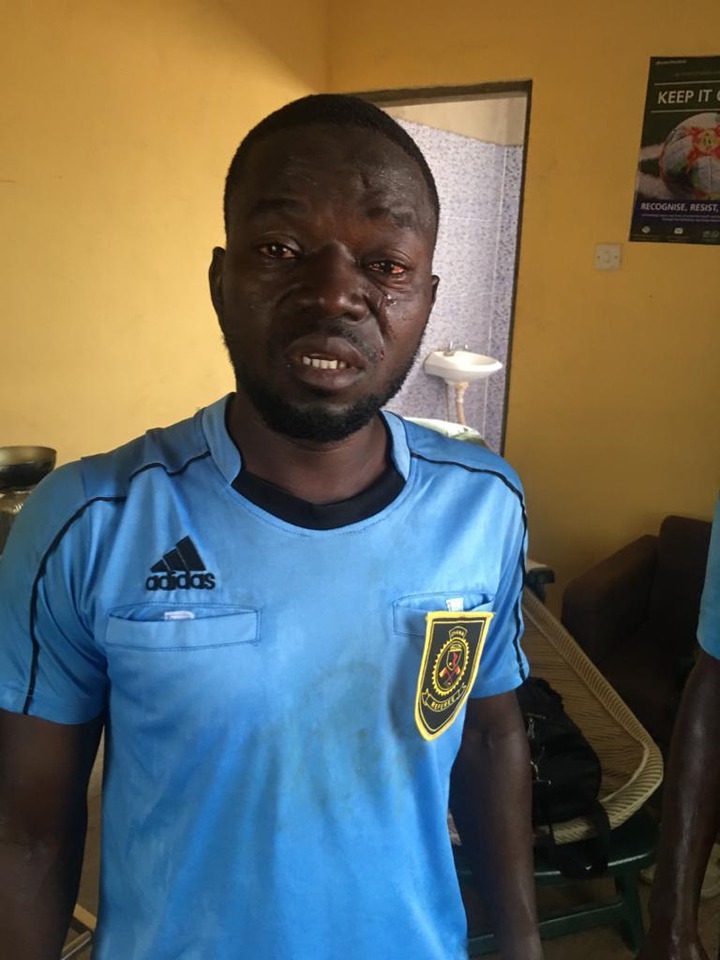 Angry fans beat up match officials with center referee losing some of his teeth in Ghana division one league match (photos)