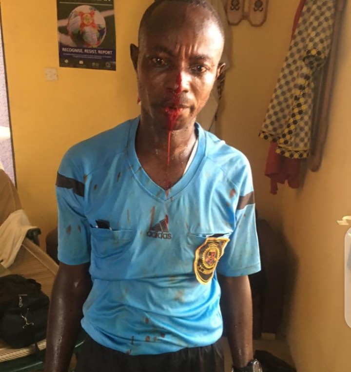 Angry fans beat up match officials with center referee losing some of his teeth in Ghana division one league match (photos)