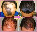 Packing Gel Styles Opera News Nigeria