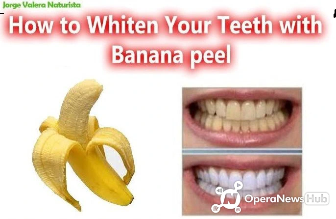 How To Whiten Your Teeth With Banana Peels And Others In One Day