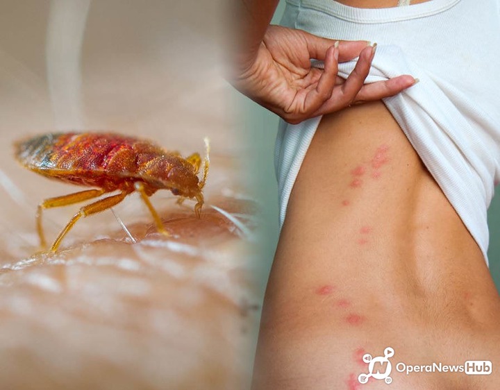 How To Get Rid Of Bed Bugs Operanewsapp