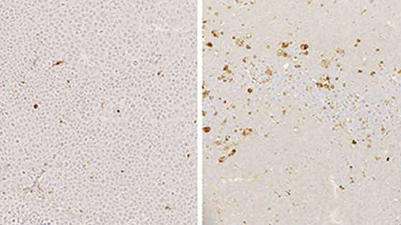 Researchers use custom molecule to halt growth of multiple myeloma and diffuse large B cell lymphoma in mice