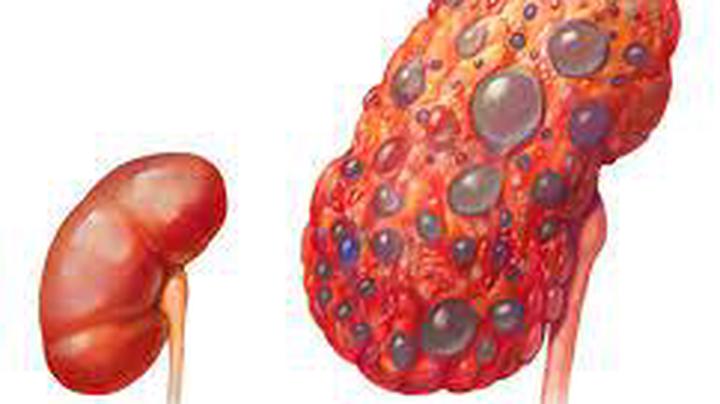 once-you-begin-to-observe-these-signs-in-your-body-pay-attention-to-your-kidney