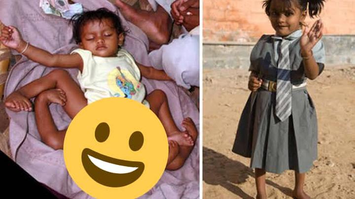 remembering-the-girl-born-with-4-legs-and-how-she-now-looks-after-her-surgery