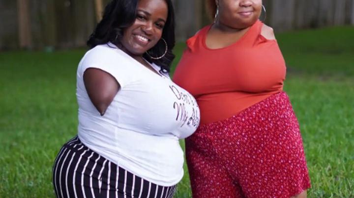 do-you-remember-the-two-best-friends-born-without-limbs-and-arms-check-out-their-inspiring-story