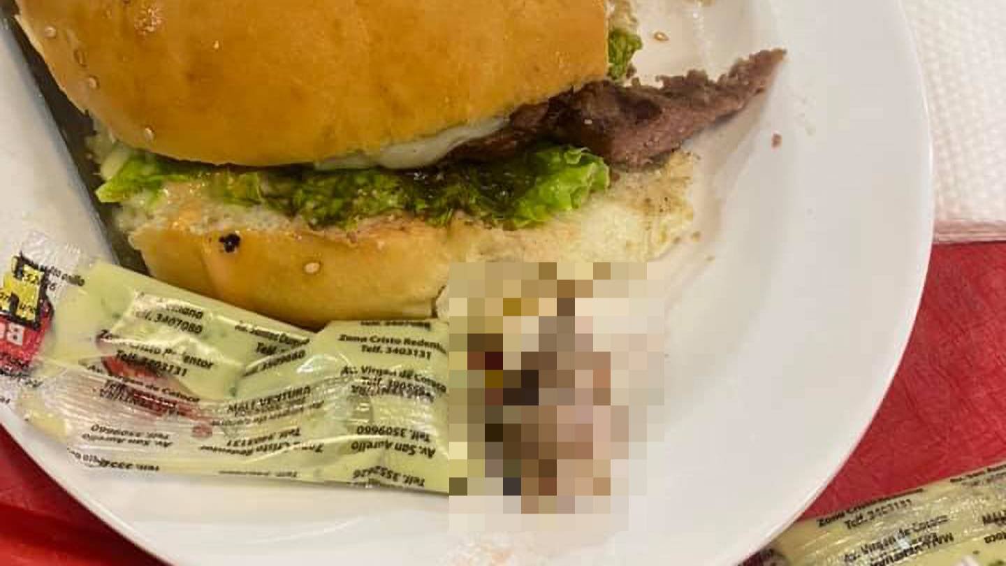 Woman chomps on rotting human FINGER after first bite of hamburger - Opera News