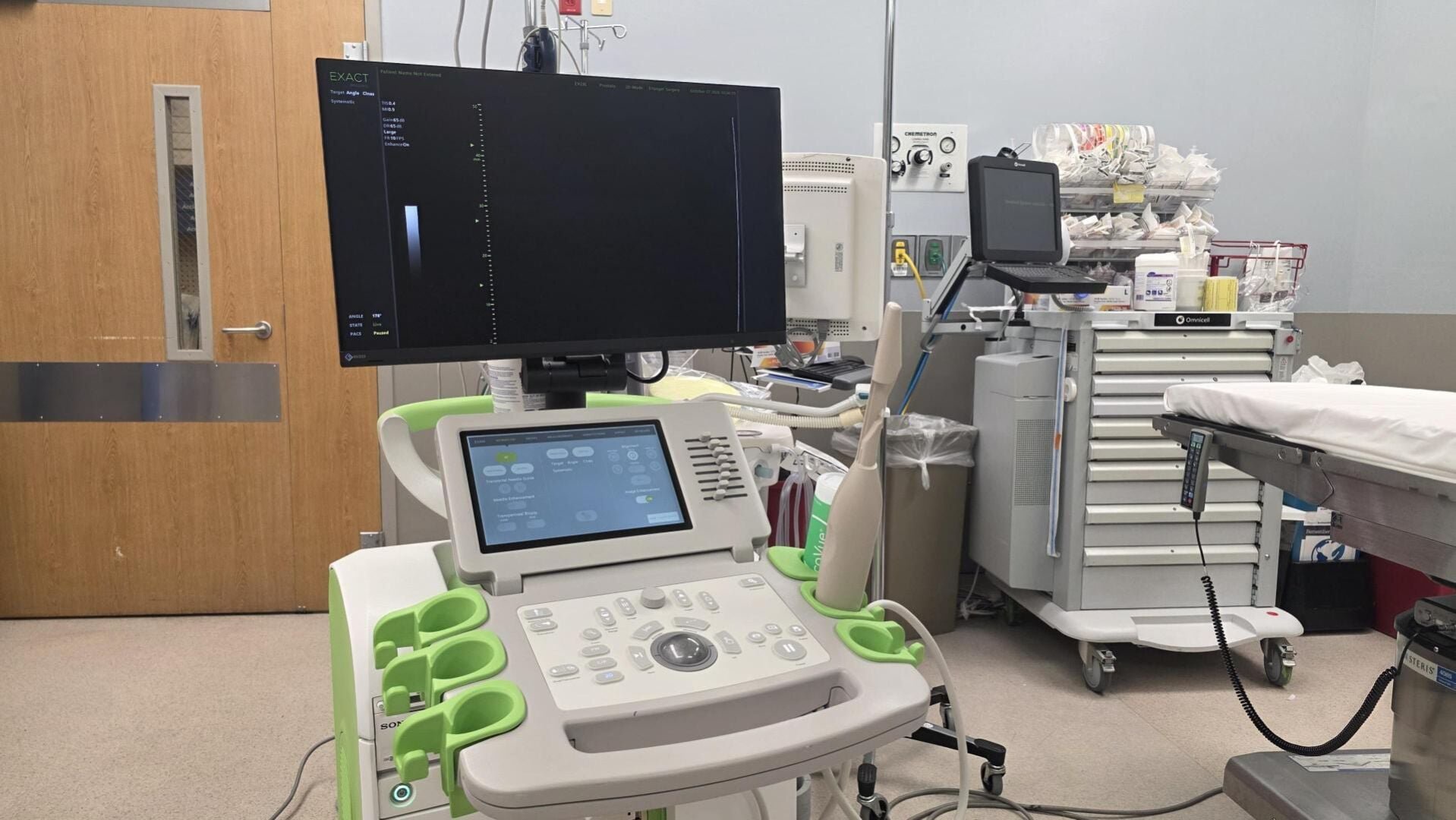 EYE ON HEALTH: New ultrasound can detect prostate cancer