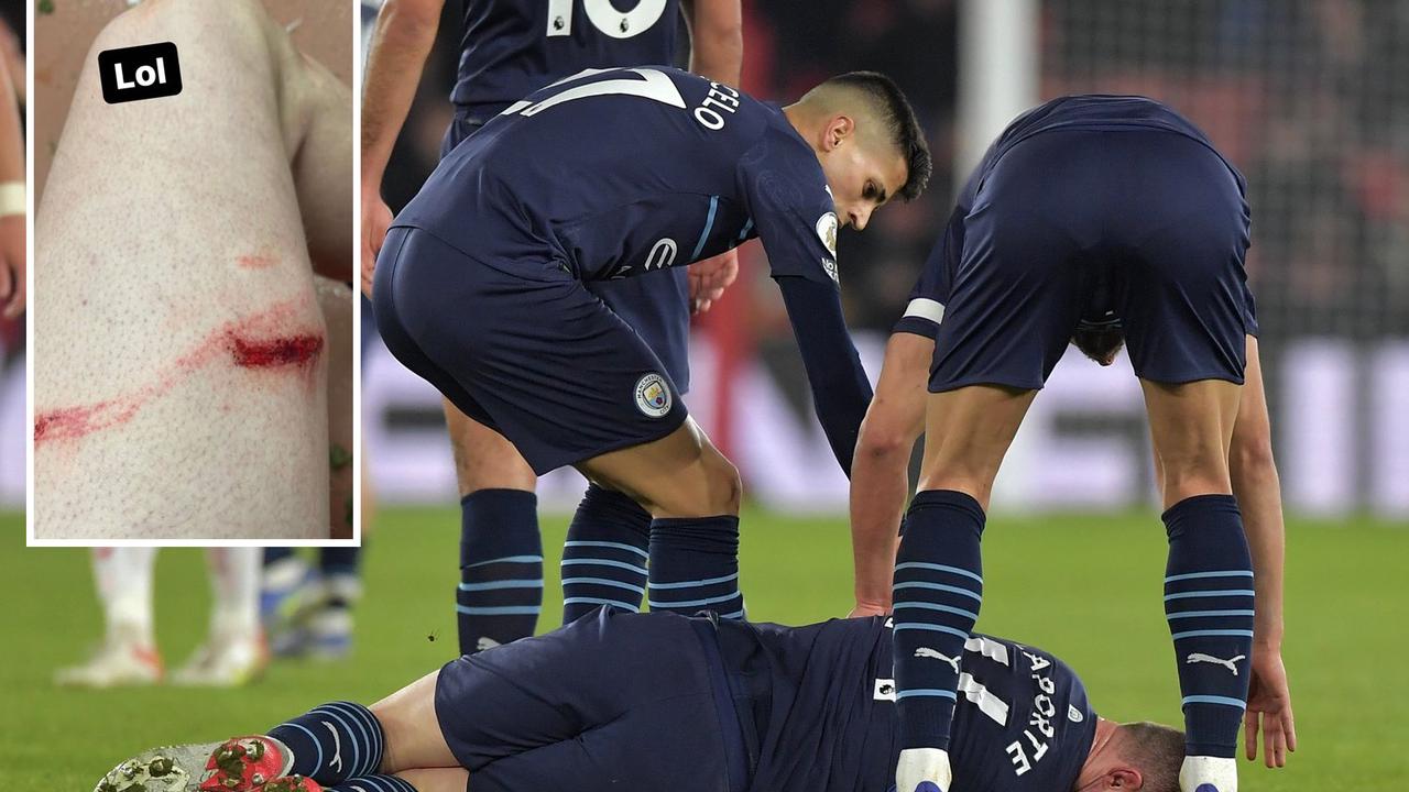 Man City ace Laporte shows horror gash on thigh after fierce Armstrong challenge