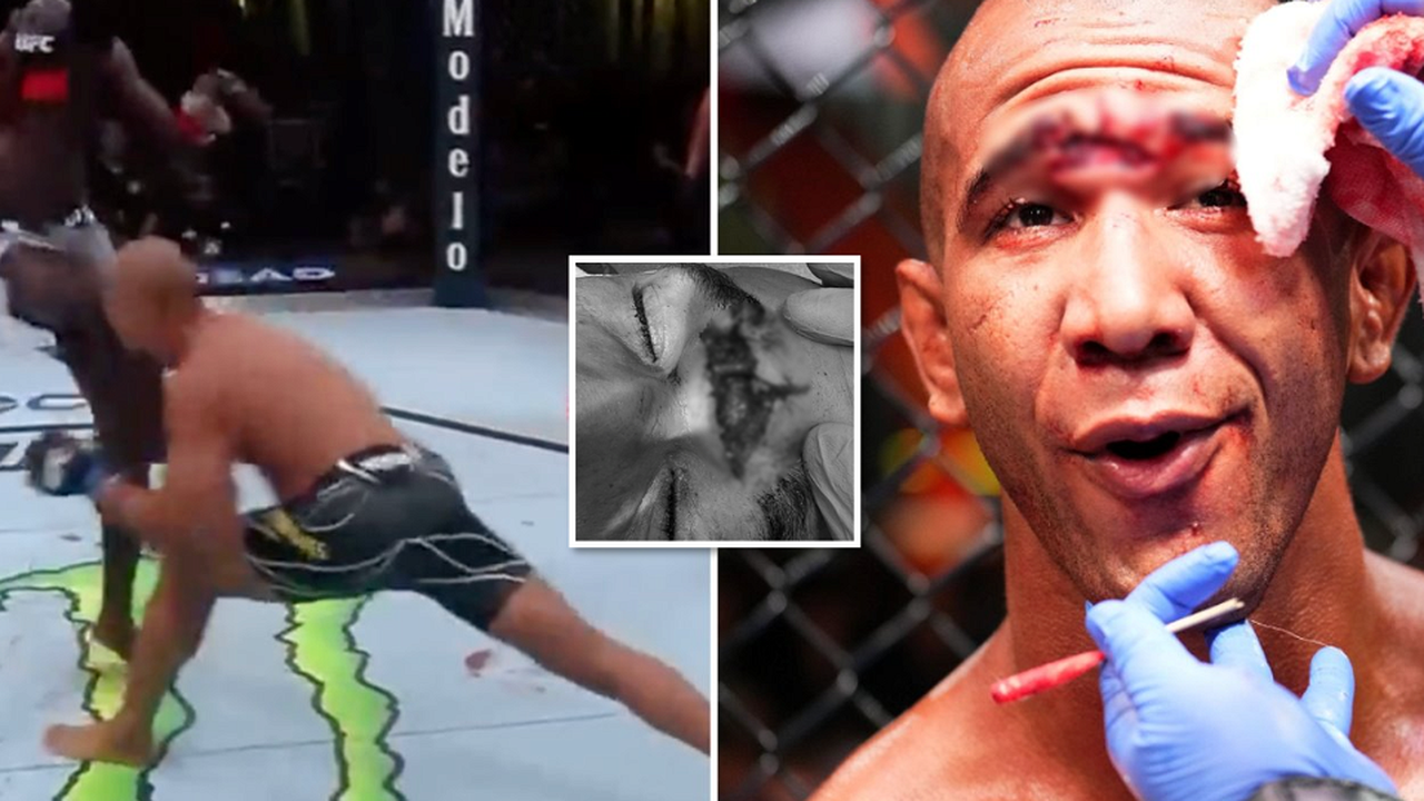 UFC's worst injuries: Gregory Rodrigues' gruesome cut is hard to look at