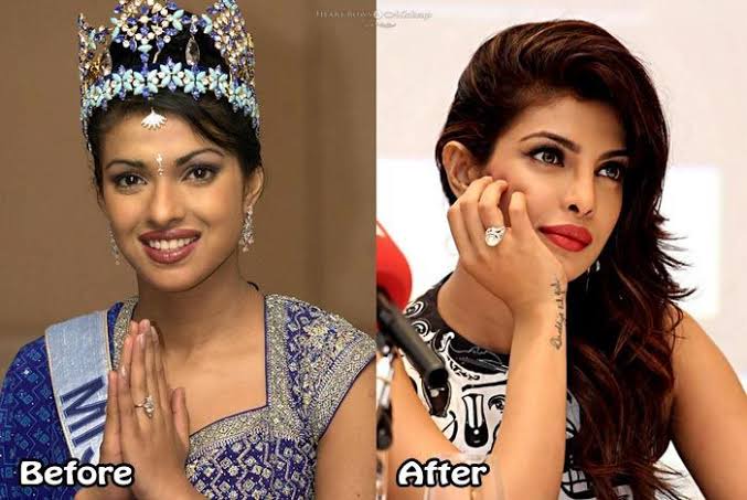 Bollywood actresses who did plastic surgery on their faces