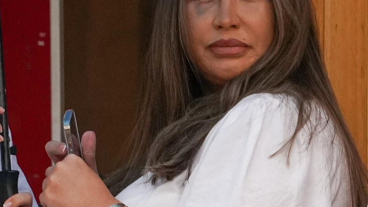 Lauren Goodger's black eye is clearly visible at Jake McClean's funeral as she says late ex will 'look after angel' daughter Lorena in heartbreaking tribute - two weeks after she was 'attacked' on the day of her baby's funeral