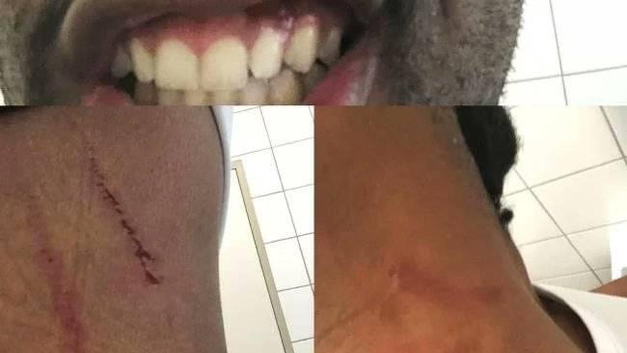 Trouble for Somizi as Mohale’s bruised pictures got revealed to the public.