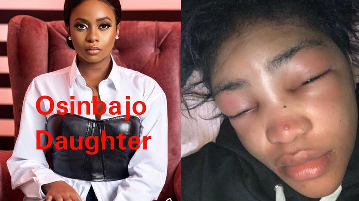 osinbajo-daughter-is-beautiful-but-have-you-seen-this-lady-before-she-got-scar-face-see-her-photos