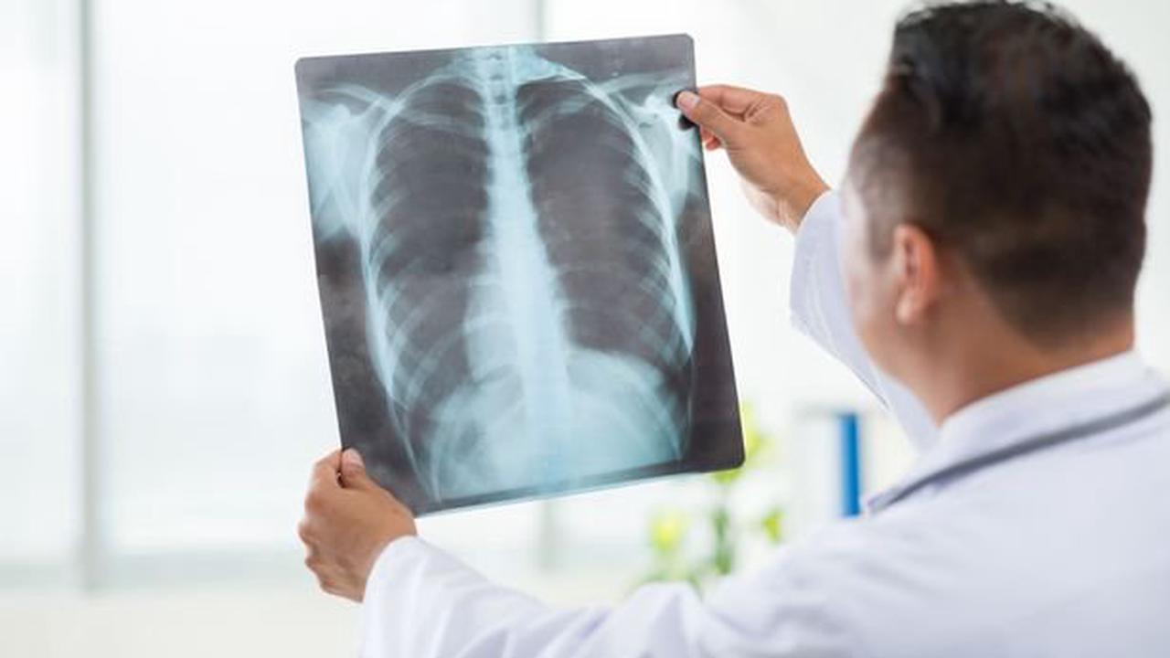 AI tech could use X-rays to diagnose Covid-19 in minutes