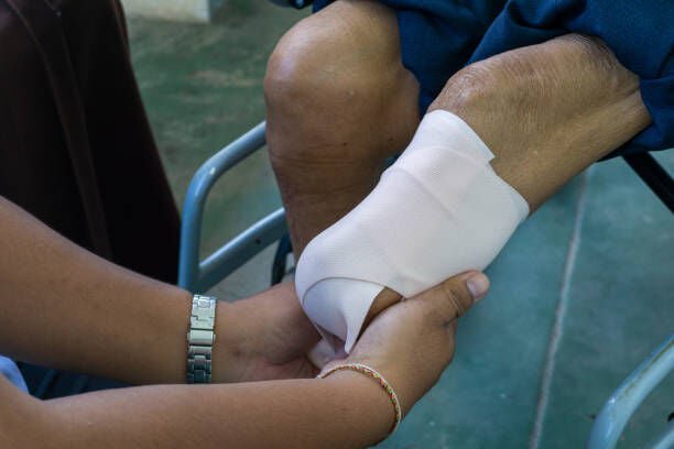 How a Preexisting Medical Condition Can Affect an Amputation Injury Claim