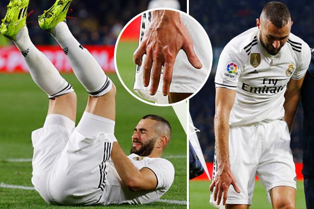 Why Karim Benzema still wears a bandage on his hand