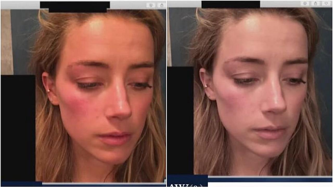 Johnny Depp's defense accuses Amber Heard of photo manipulation