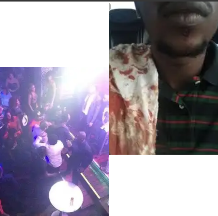 944661828e1104aadcdf2ee8dea5c289?quality=uhq&format=webp&resize=720&watermark=true