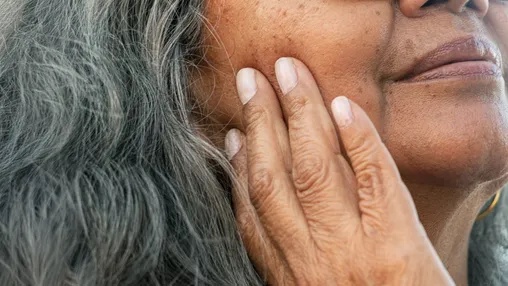 What Are Age Spots (Liver Spots)?