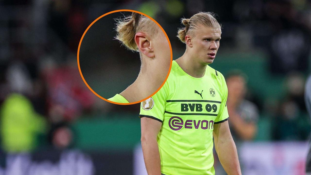 Mit einem Fleck am Hals sorgte BVB-Star Erling Haaland für Aufsehen | Fussball