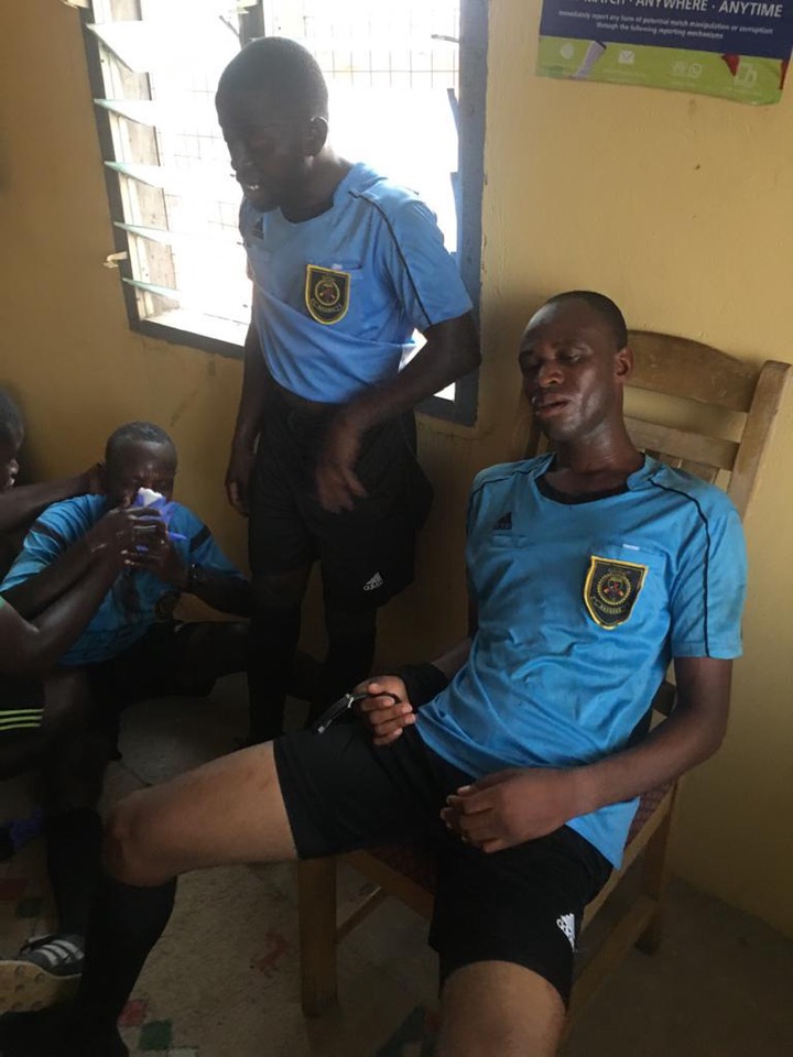 Angry fans beat up match officials with center referee losing some of his teeth in Ghana division one league match (photos)