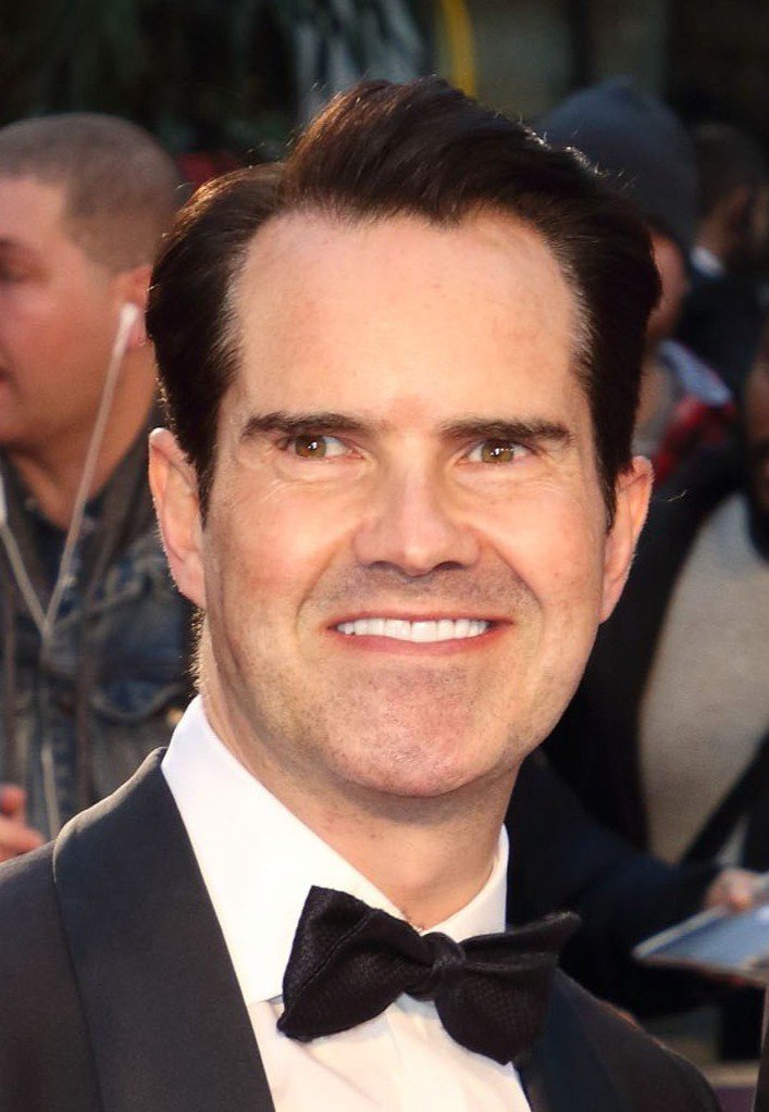 jimmy carr hair transplant