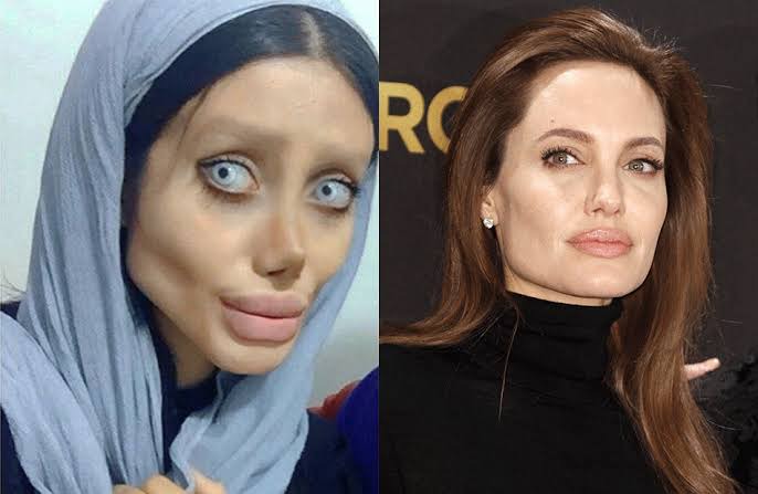 People who went too far to look like celebrities