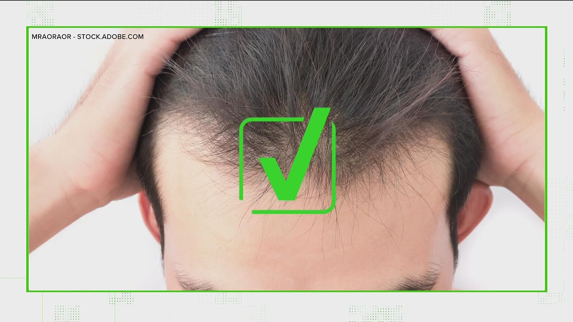 Verify Yes Covid 19 Can Cause Hair Loss Opera News