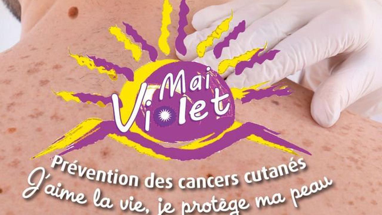 Mai Violet : l’opération contre le cancer de la peau