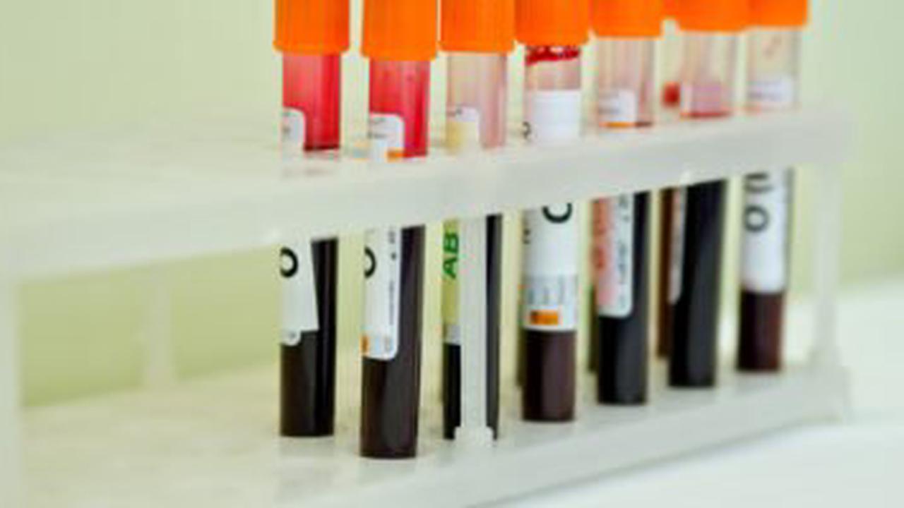 Cancer : Un simple test sanguin pour prévenir la maladie